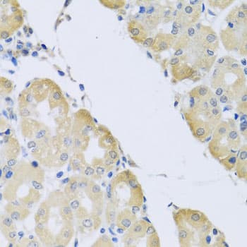 Polyclonal Rabbit anti-Human ATP2C1 Antibody (IHC, WB)