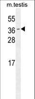 ODF3 Antibody (aa170-199)