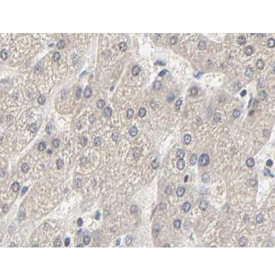 Acetyl-CoA Carboxylase / ACC Antibody (phospho-Ser80)
