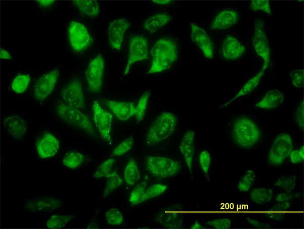 Monoclonal Mouse anti-Human ARA70 / NCOA4 Antibody (clone 1F11, IHC, IF, WB)