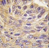 Polyclonal Rabbit anti-Human PTPN9 / MEG2 Antibody (aa477-505, IHC, WB)