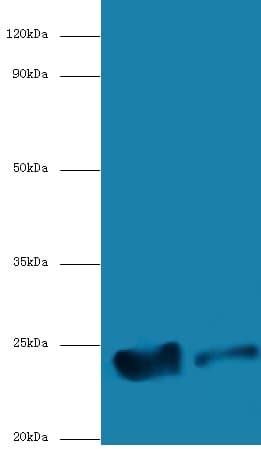 ICT1 / DS1 Antibody (Biotin)