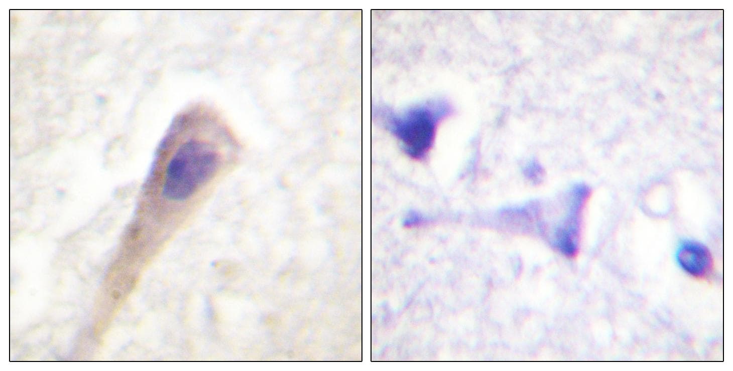 Polyclonal Rabbit anti-Human CAT / Catalase Antibody (phospho-Tyr385, IHC, WB)