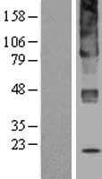 Human UGCG Protein (Over-Expression Lysate Myc-DDK (Flag))
