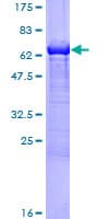 Human MVK Protein (Recombinant GST)