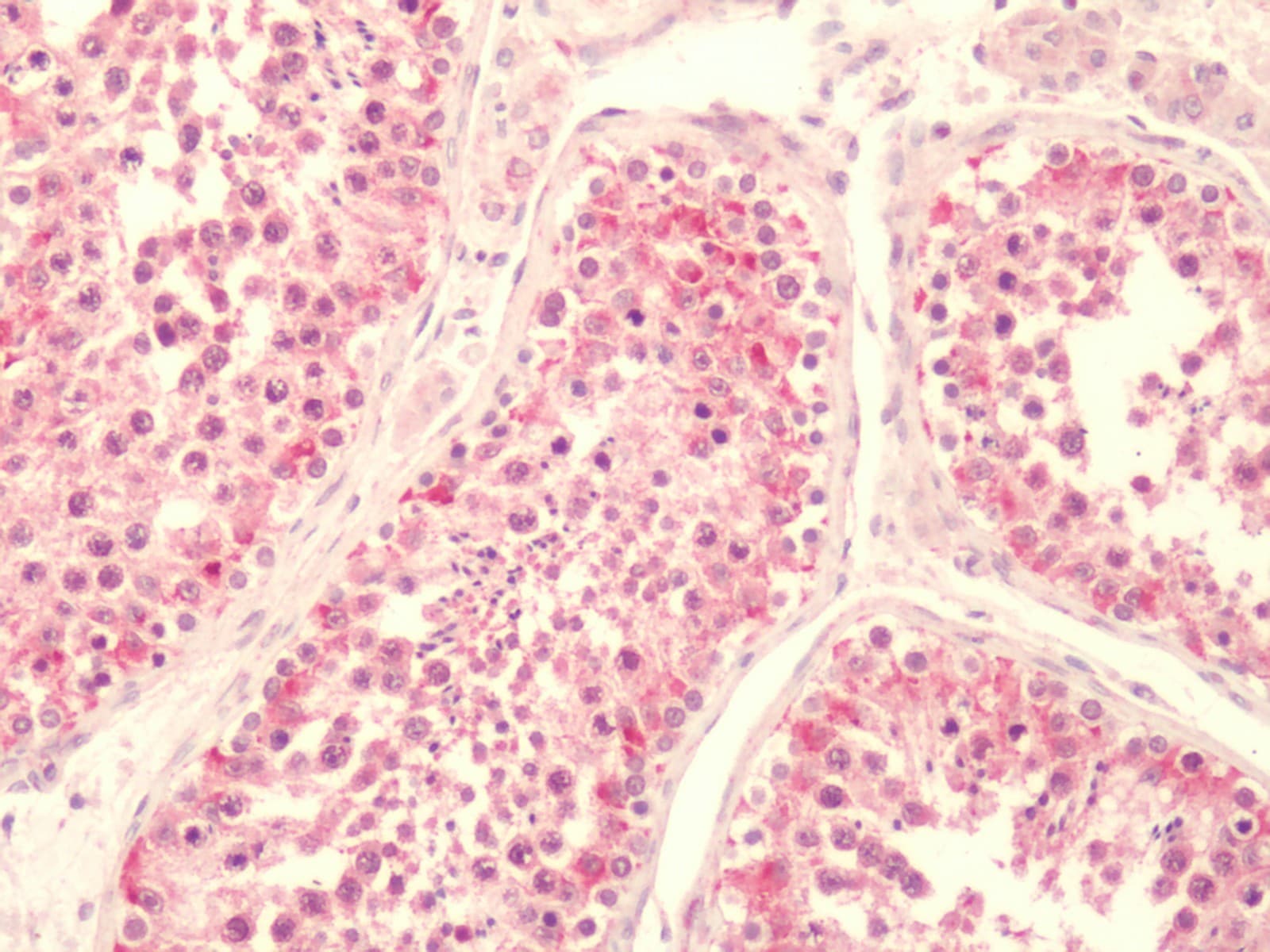 PathPlus™ Polyclonal Rabbit anti-Human LPAR5 / GPR92 Antibody (C-Terminus, IHC)
