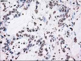 PLK1 / PLK-1 Antibody (clone OTI1D4)