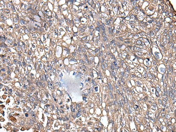Polyclonal Rabbit anti-Human KRT73 / Keratin 73 Antibody (IHC)