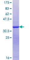Human SUMF1 Protein (Recombinant GST, N-terminus)