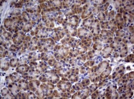 PIK3C2A Antibody (aa230-560, clone OTI3H2)