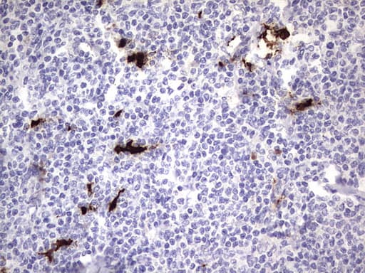 S100A9 / MRP14 Antibody (clone OTI11A12)