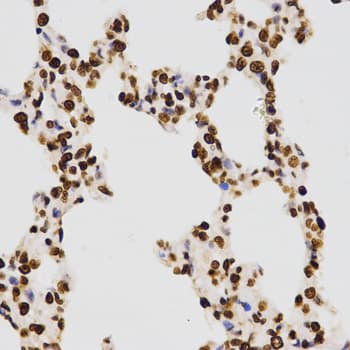 Histone H3 Antibody (Dimethyl-Lys27)