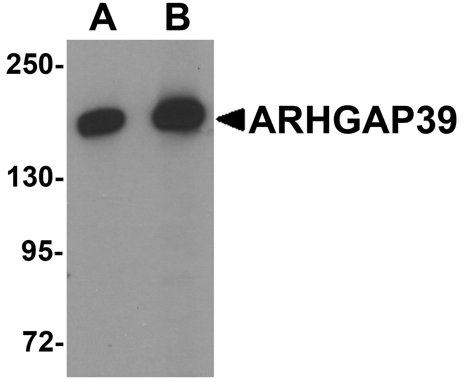 Polyclonal Rabbit anti-Human ARHGAP39 Antibody (WB)