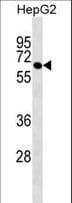 PTBP3 / ROD1 Antibody (aa253-279)