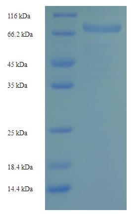 Human SPAM1 / PH20 Protein (Recombinant His-SUMO)