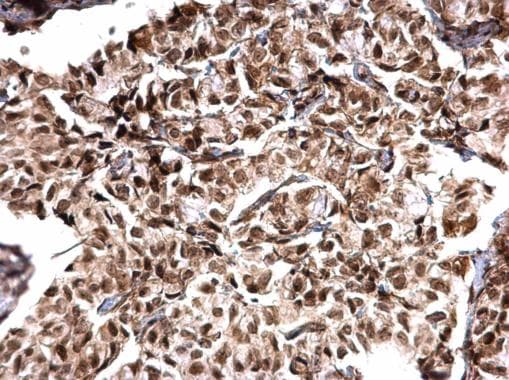 MTA1 Antibody (aa391-708)