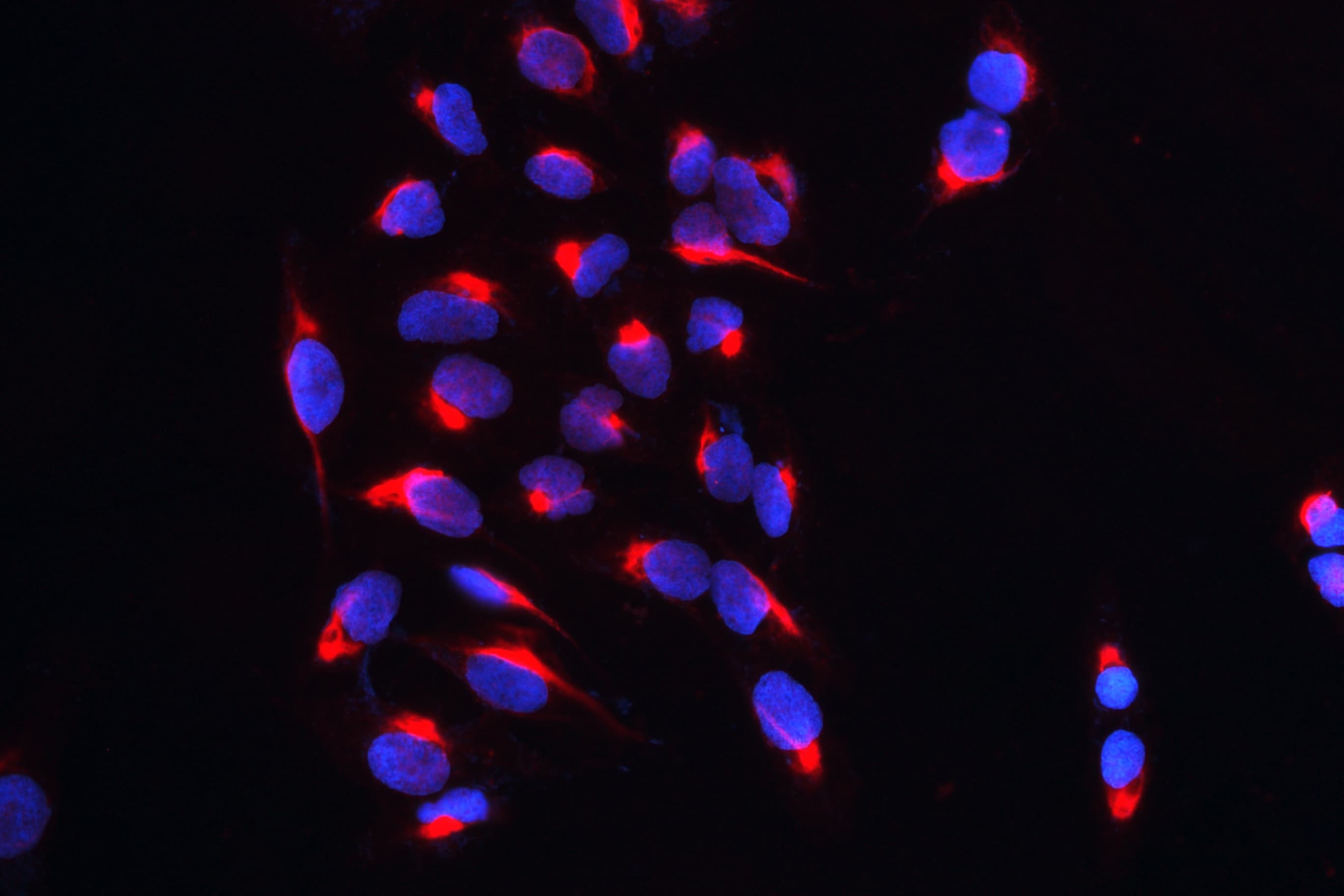 Polyclonal Rabbit anti-Human CARS1 / CARS Antibody (WB)