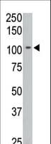 PTPRN2 / Phogrin Antibody (aa94-125)