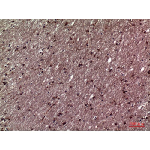 HSD11B1 / HSD11B Antibody (1-50 aa, N-terminal)