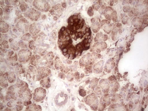 ABAT Antibody (aa29-323, clone OTI7H1)