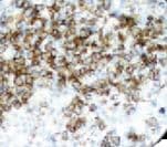 IL3RA / CD123 Antibody (Ready-to-Use)