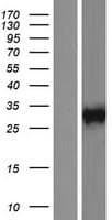 KLRC1 / NKG2A / CD159a Protein (Over-Expression Lysate Myc-DDK (Flag))