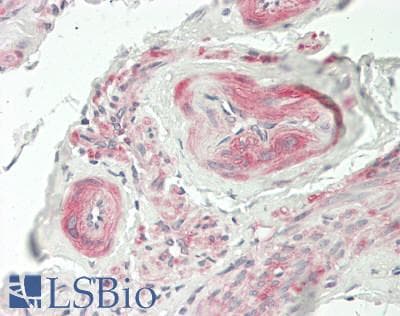 IHC-plus™ FBLIM1 / Migfilin Antibody (aa294-323)