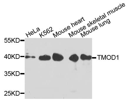 Polyclonal Rabbit anti-Human TMOD1 / Tropomodulin 1 Antibody (WB)