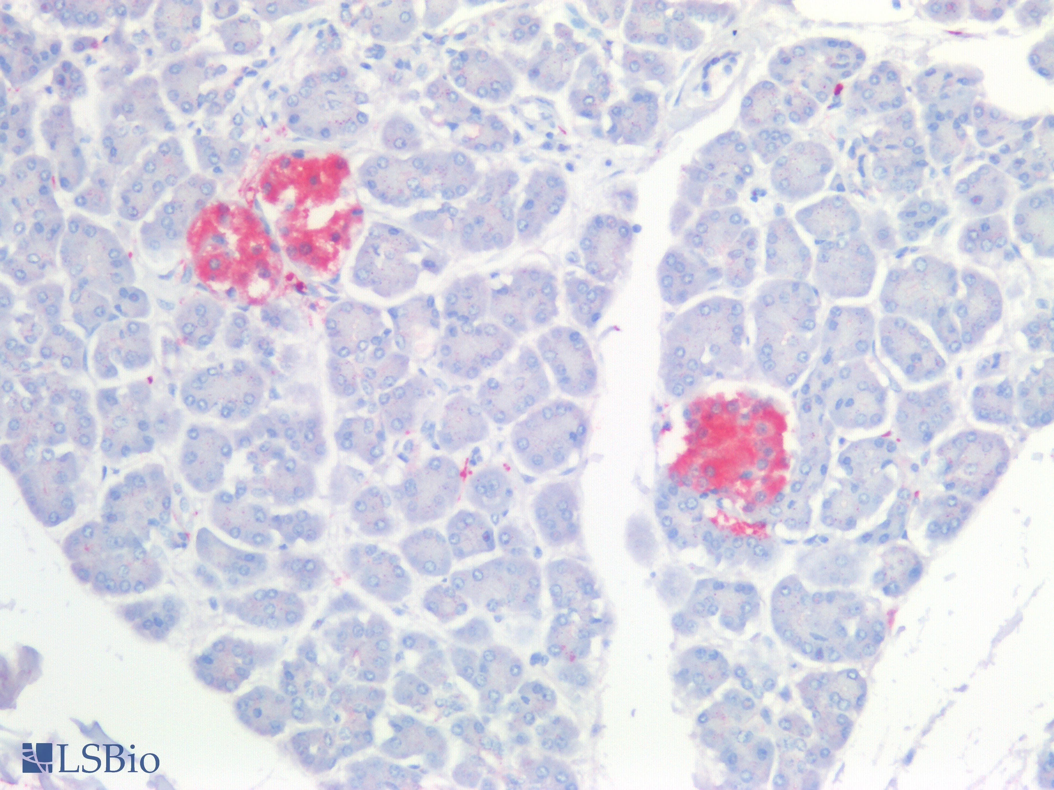 PathPlus™ UCHL1 / PGP9.5 Antibody (aa150-C-term)