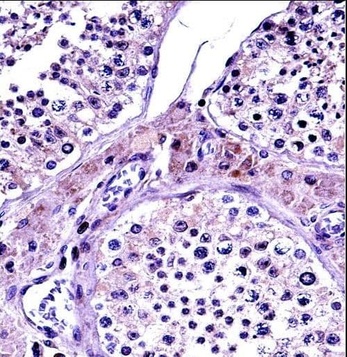 Polyclonal Rabbit anti-Human NR0B1 / DAX1 Antibody (aa304-333, IHC, WB)