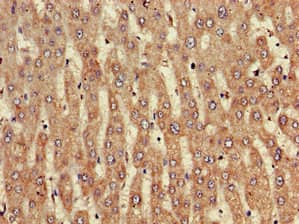 Polyclonal Rabbit anti-Human NINJ1 / Ninjurin Antibody