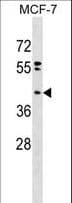 PPAPDC2 Antibody (aa70-96)