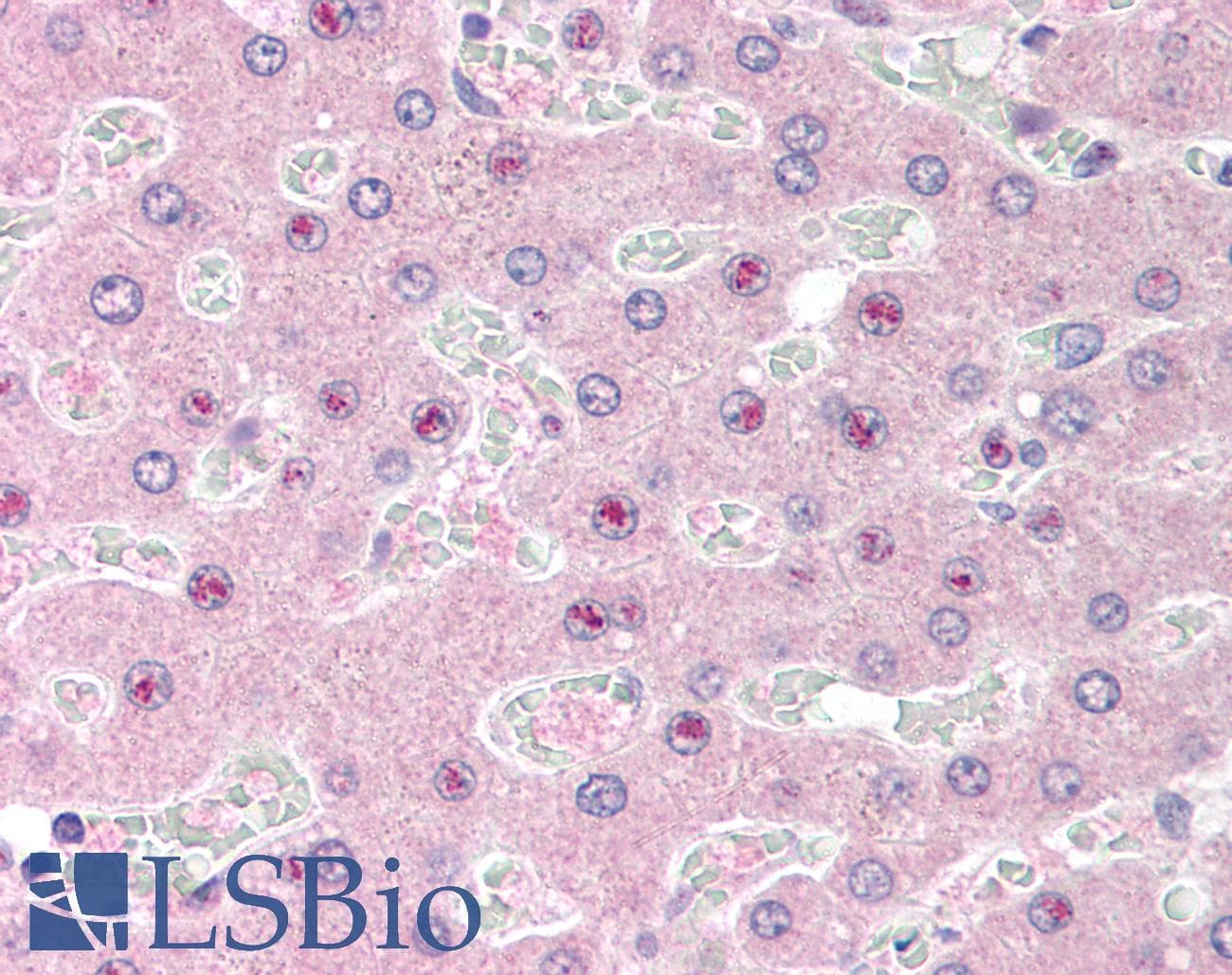 IHC-plus™ Polyclonal Goat anti-Human SLC25A47 / C14orf68 Antibody (aa85-97, IHC)
