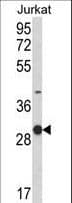 KLRC1 / NKG2A / CD159a Antibody (aa180-206)