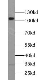 Polyclonal Rabbit anti-Human PCDH10 Antibody (IHC, IF, WB)