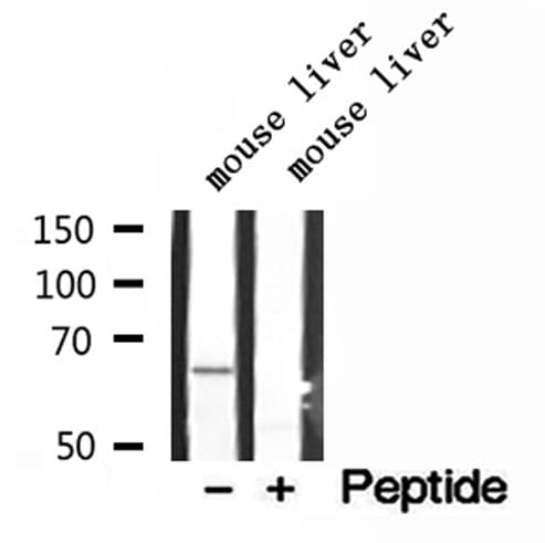 LARP7 Antibody