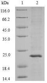Streptococcus pyogenes APRT Protein (Recombinant 10His, N-terminus + Myc, C-terminus)