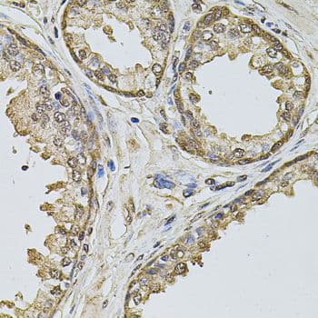 CCNA2 / Cyclin A2 Antibody