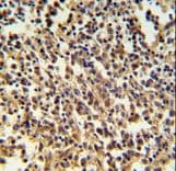 RNASEH2B Antibody (aa130-157)
