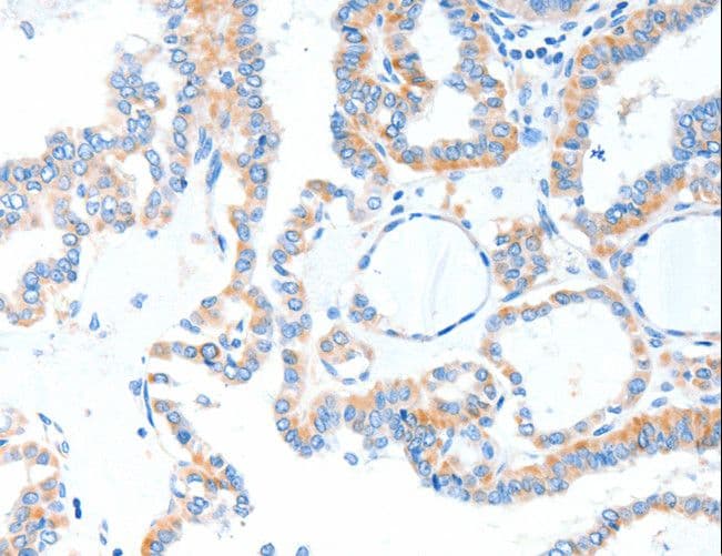 Polyclonal Rabbit anti-Human TLR2 Antibody (IHC)