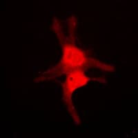 Polyclonal Rabbit anti-Human MAPK10 / JNK3 Antibody (C-Terminus, IF, WB)