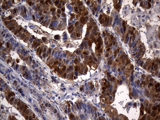 CSE1L Antibody (aa1-300, clone OTI4G1)