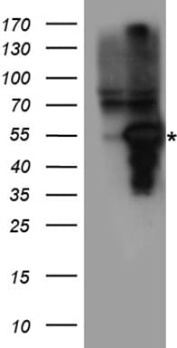 Polyclonal Rabbit anti-Human MMP11 Antibody (WB)