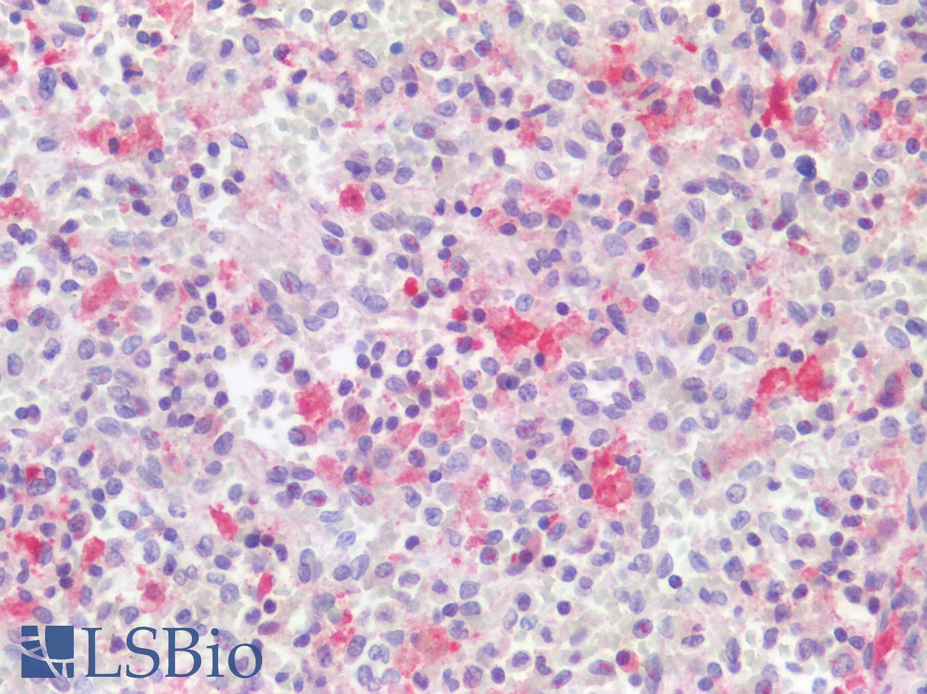NKP30 Antibody (aa104-153)