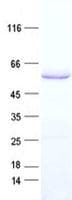 Human KRT77 / Keratin 77 / KRT1B Protein (Recombinant His, N-Terminal)