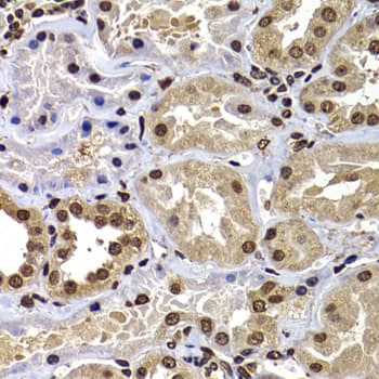 Polyclonal Rabbit anti-Human DNAJB6 Antibody (IHC, IF, WB)