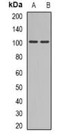 GRIA4 / GLUR4 Antibody (C-Terminus)