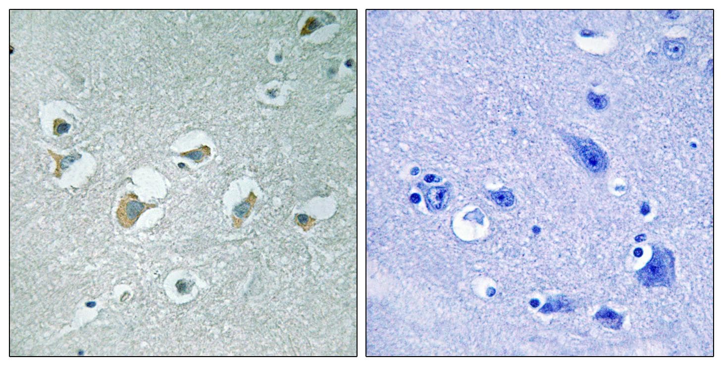 MLK1+2 Antibody (phospho-Thr312/266)