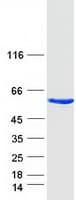 Human ANXA11 / Annexin XI Protein (Recombinant Myc-DDK (Flag))