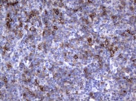 Monoclonal Mouse anti-Human FCER2 / CD23 Antibody (clone OTI3A2, IHC, WB)